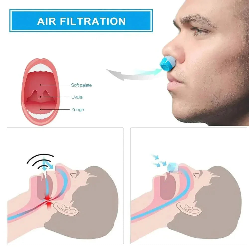Micro CPAP | Hoseless, Quiet & USB-Rechargeable